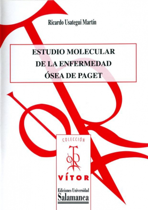 Cubierta para Estudio molecular de la enfermedad ósea de Paget